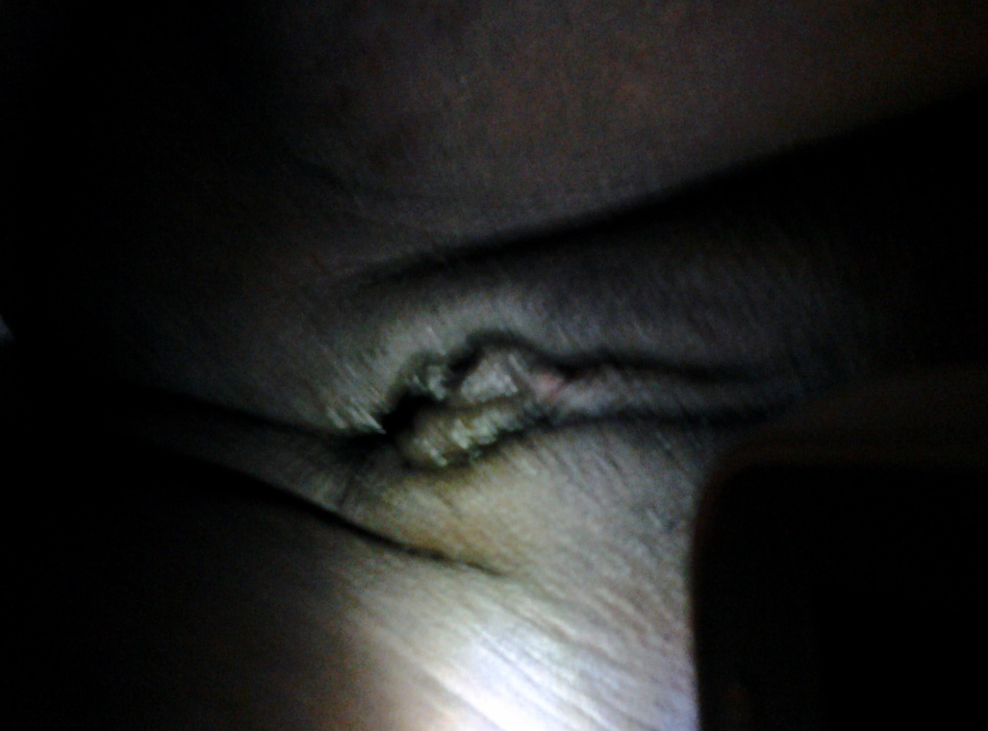 anal rupe curul jpg anal rupe curul