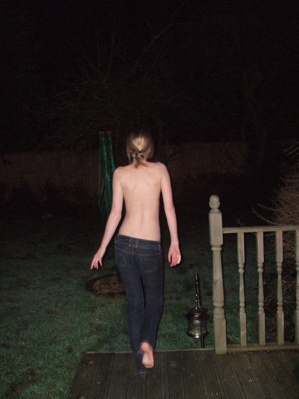 poze cu pizde romance pielea